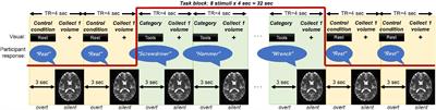 The association between language-based task-functional magnetic resonance imaging hemodynamics and baseline GABA+ and glutamate–glutamine measured in pre-supplementary motor area: A pilot study in an aging model